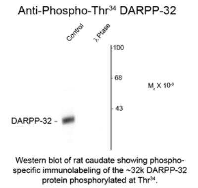 Western Blot: DARPP-32 [p Thr34] Antibody [NB300-224]